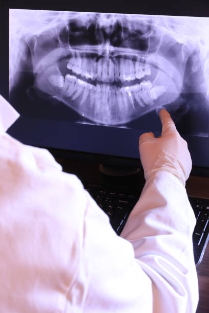 Best Emergency Dental Care for Abscessed Tooth in Steep Falls, ME