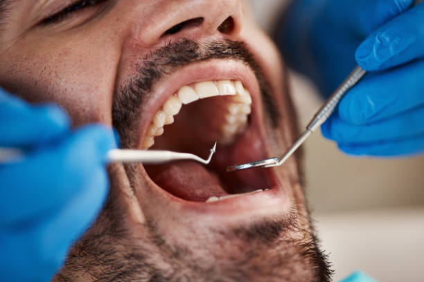 Best Emergency Root Canal Treatment in Steep Falls, ME